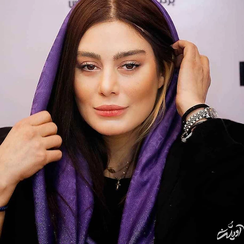  عکس - سحر قریشی خودش را زشت کرد - بلای ناگوار عمل زیبایی بر سر خانم بازیگر جذاب !